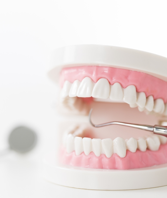 歯科模型を使った歯周病治療のイメージ