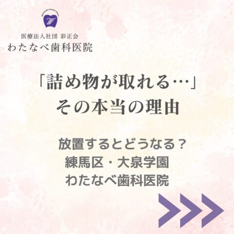 練馬区 大泉学園 詰め物が取れる 理由 放置リスク わたなべ歯科医院